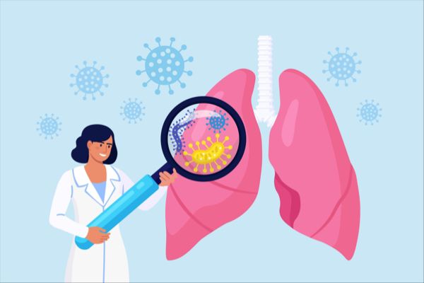 Bristol Myers Squibb Reports KRYSTAL-12 Study Success with KRAZATI (Adagrasib) Halting Advanced KRASG12C-Mutant NSCLC Progression