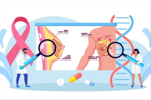 DAN-222 from Dantari shows promise in reducing tumors in advanced HER2-negative breast cancer