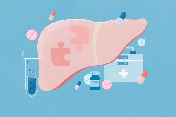 Durvalumab (IMFINZI®) plus TACE and bevacizumab reduced liver cancer progression or mortality risk by 23%