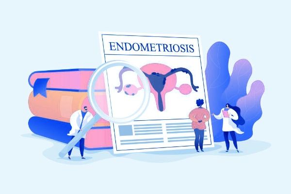 Anti-Netrin-1 Antibody Shows Potential in Combating Endometrial Cancer